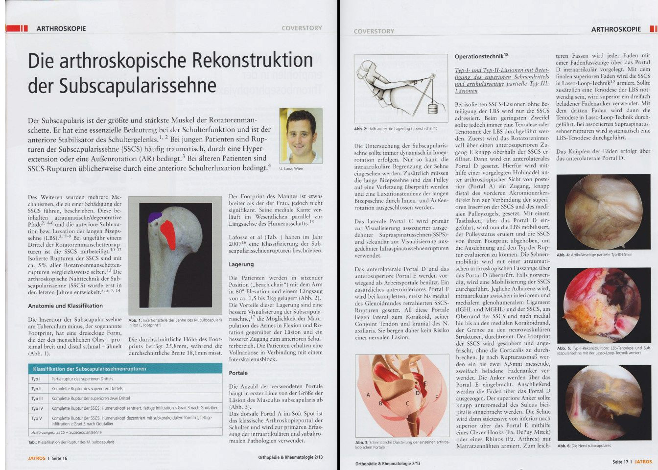 Die-arthroskopische-Rekonstruktion-der-Subcapularissehne_Jatros_Seite 1u2